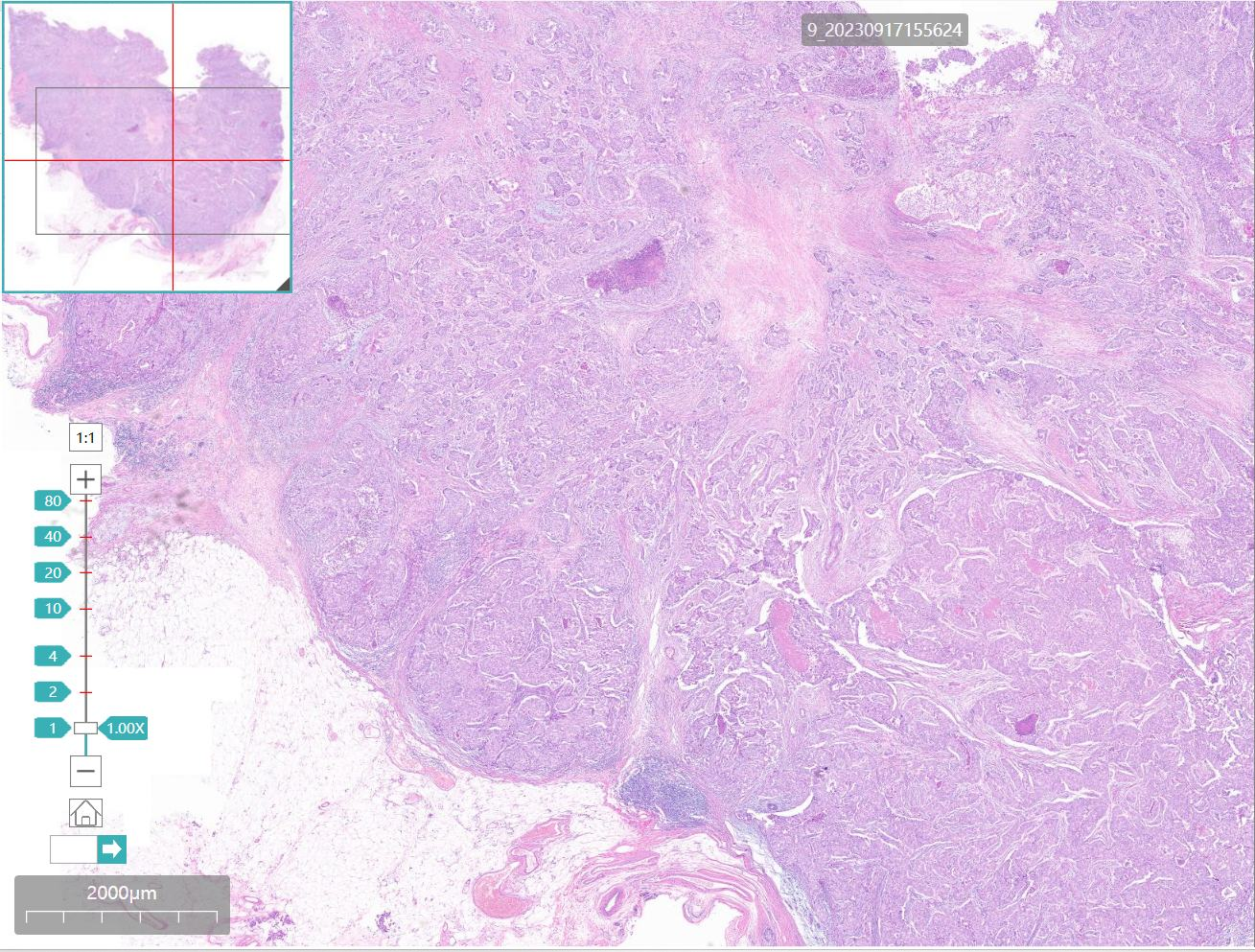 pathology slide labeling