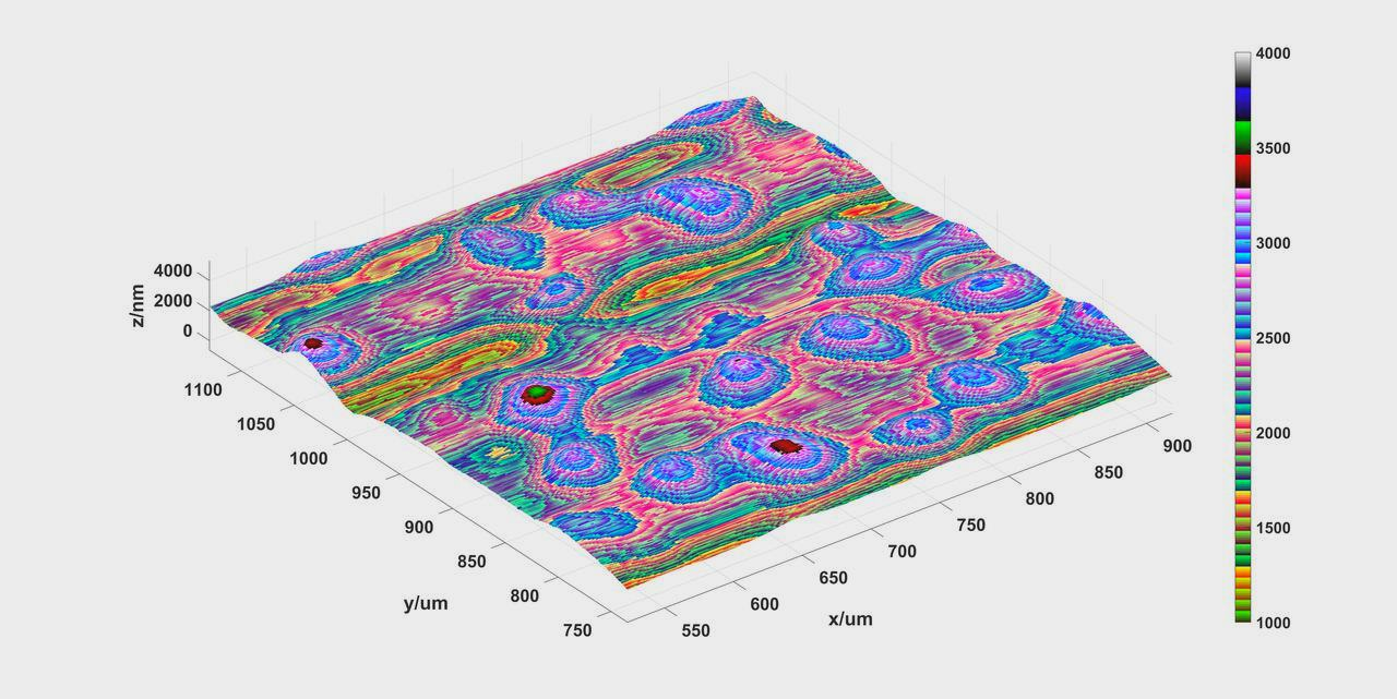 3D tissue surface analysis